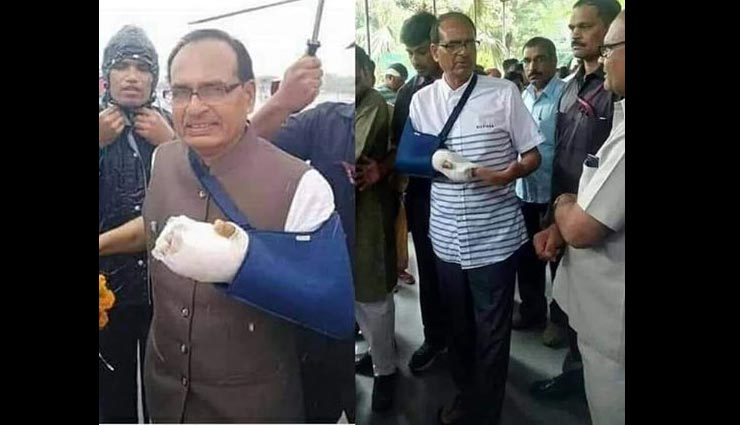 क्या शिवराज सिंह चौहान कर रहे हैं हाथ में फ्रैक्चर का नाटक या..., जाने क्या है सच