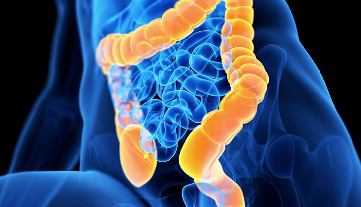 8 Effective Home Remedies To Treat Short Bowel Syndrome