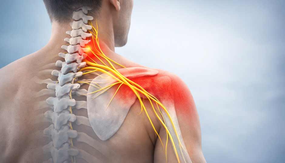 12 Home Remedies to Treat Shoulder Pain Naturally