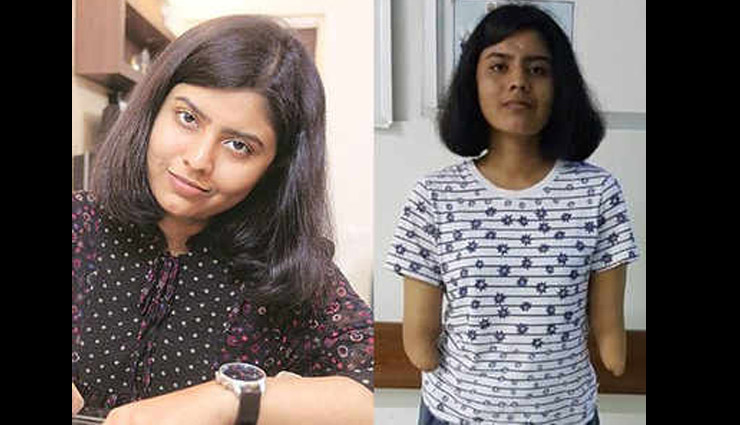 हादसे में कटे थे हाथ, फिर ट्रांसप्लांट ने बदल दी श्रेया की जिंदगी
