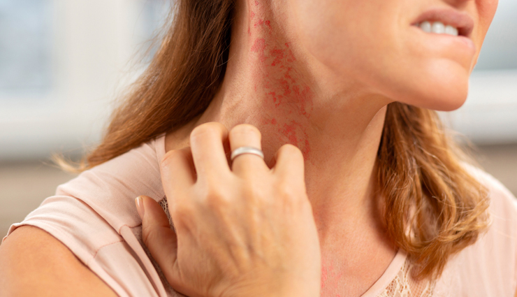 side effects of eating clementines,clementines,Health tips,fitness tips