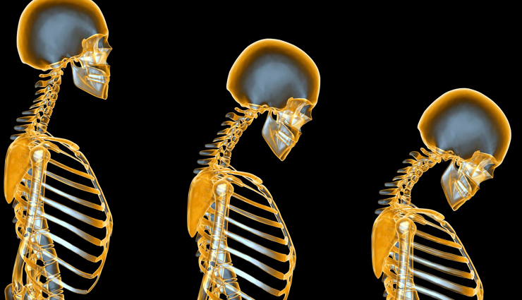 world thyroid day,side effects of overactive thyroid,thyroid health tips,Health tips,fitness tips