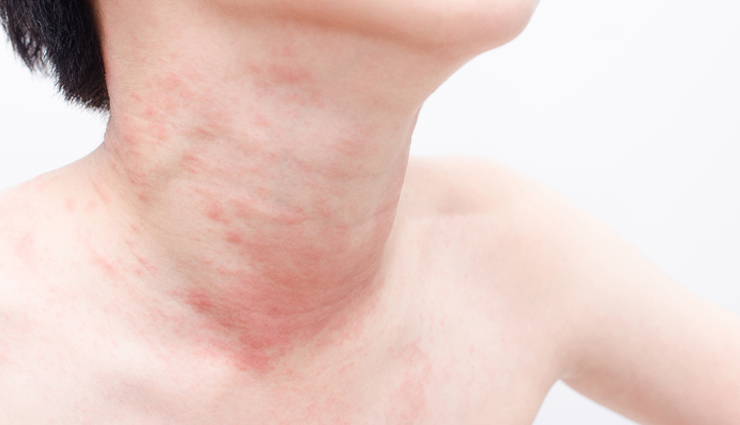 peanuts and their negative health effects,dangers of excessive peanut consumption,side effects of eating too many peanuts,health risks of overindulging in peanuts,peanuts and their harmful consequences,the downside of eating too many peanuts,adverse effects of consuming large amounts of peanuts,peanut overdose and its consequences,risks of excessive peanut intake,negative consequences of eating peanuts in excess