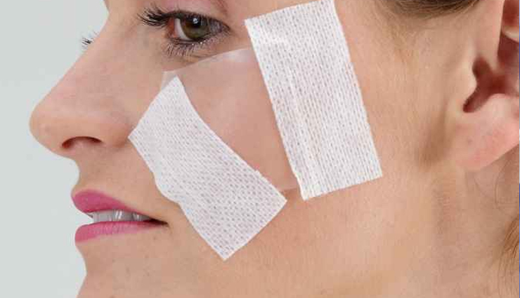 pitted acne scars remedies,acne scar treatment methods,home remedies for acne pitting,natural remedies for pitted scars,treating indented acne scars naturally,diy remedies for pitted acne scars,effective treatments for depressed acne scars,how to heal pitted acne scars,scar reduction remedies,skin care for pitted acne scars