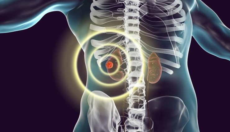 sirsasana health benefits,benefits of headstand pose,mind-blowing sirsasana advantages,health benefits of yoga headstand,sirsasana impact on well-being,sirsasana for mental health,headstand pose benefits for body,sirsasana impact on physical health,yoga headstand benefits for health,sirsasana advantages for mind and body,headstand pose health benefits,sirsasana advantages for vitality,mental health benefits of yoga headstand,sirsasana effects on body wellness,yoga headstand perks for mind and body,sirsasana impact on holistic health,headstand pose benefits for strength,sirsasana advantages for emotional balance,sirsasana benefits for inner well-being,yoga headstand advantages for vitality