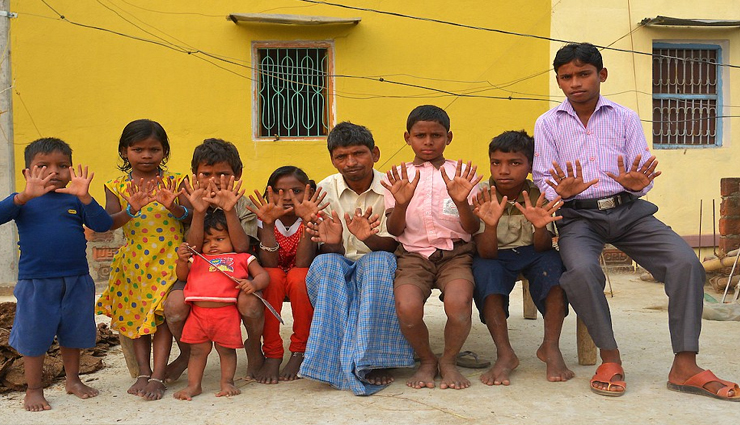 बिहार का अनोखा परिवार जहां सभी 22 सदस्यों के हाथ-पैरों में हैं 6 अंगुलियां