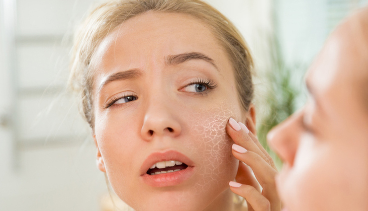 8 Tried Ways To Treat Dry Skin On Face Lifeberrys Com