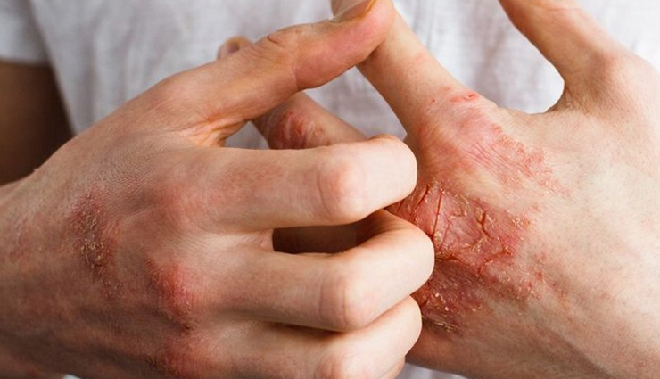 ashwagandha adverse reactions,potential risks of ashwagandha,ashwagandha safety concerns,serious side effects of ashwagandha,ashwagandha health risks,dangers of ashwagandha,ashwagandha precautions,ashwagandha toxicity,negative effects of ashwagandha,ashwagandha dangers to be aware of