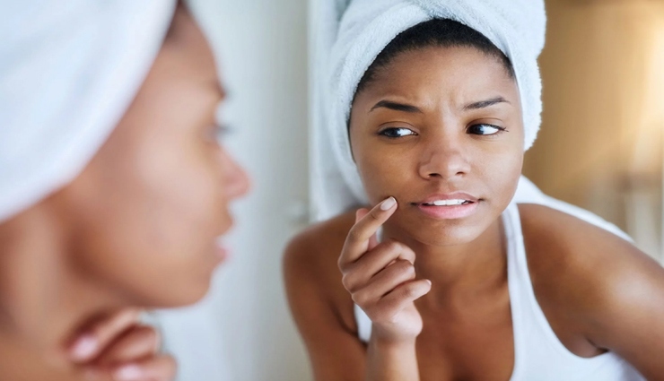 beauty tips,beauty tips in hindi,skin care tips,blackheads tips