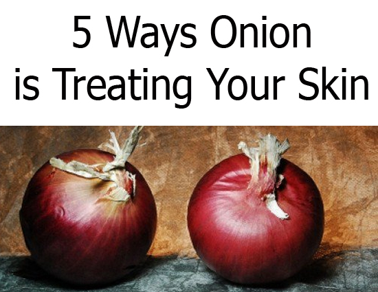 5 Ways Onion is Treating Your Skin