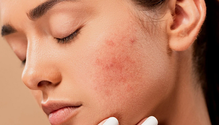 potato,health benefits of eating potato,potato health benefits,healthy food potato,potato for good health,Health,Health tips