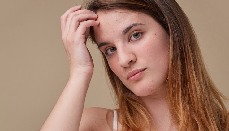 Various Surprising Reasons Why Your Skin is Breaking Out