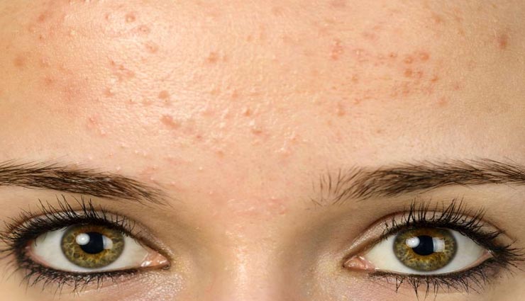 beauty tips,beauty tips in hindi,skincare tips,sensitive skin signs