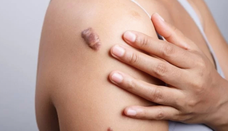 6 benefits of using marula oil for skin and hair,beauty tips,beauty hacks