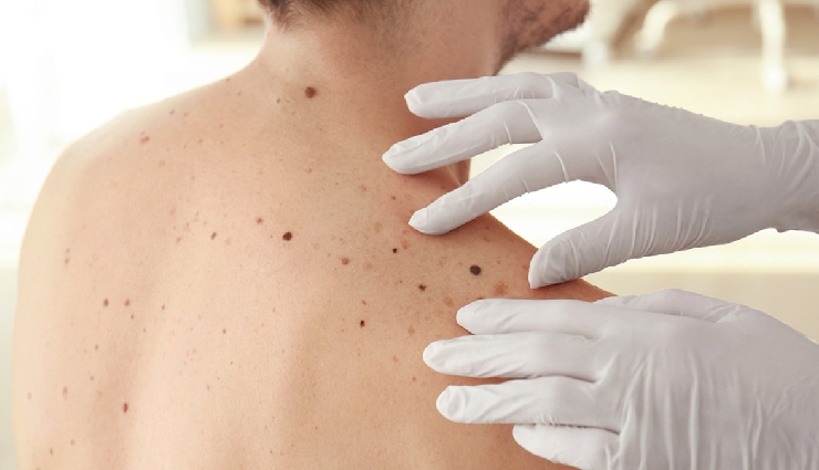 men health risks,top health concerns for men,preventable diseases in men,male health tips,men wellness,men lifestyle and health,heart disease in men,prostate health,cancer risks in men,mental health for men,men and longevity,how to stay healthy as a man