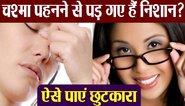 क्या आपकी नाक पर भी बन चुके हैं चश्मे के निशान, इन घरेलू नुस्खों से मिटाए इन्हें