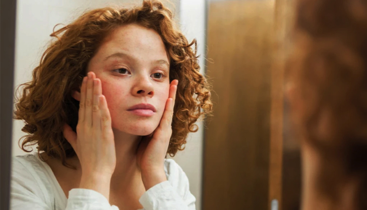 almond oil for skin,benefits of almond oil,almond oil skin care,skin care treatment with almond oil,almond oil beauty hacks,beauty,beauty tips