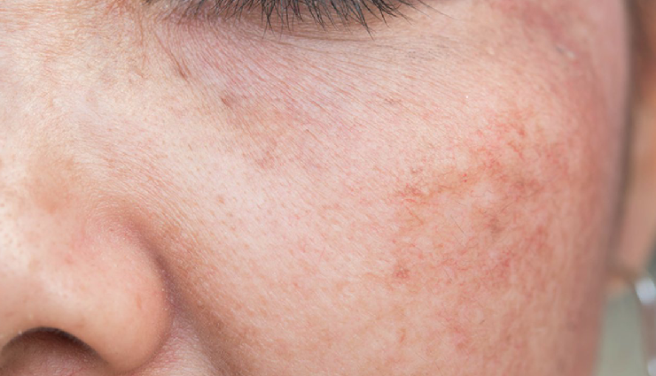 green tea benefits for skin,skin advantages of green tea,green tea skincare benefits,natural remedies for skin health,green tea for radiant skin,antioxidant-rich green tea for skin,skin rejuvenation with green tea,healthy skin with green tea consumption,green tea beauty benefits,nourish skin with green tea