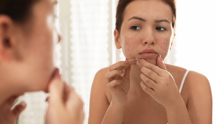 hazelnuts benefits,health benefits of hazelnuts,healthy living,Health tips