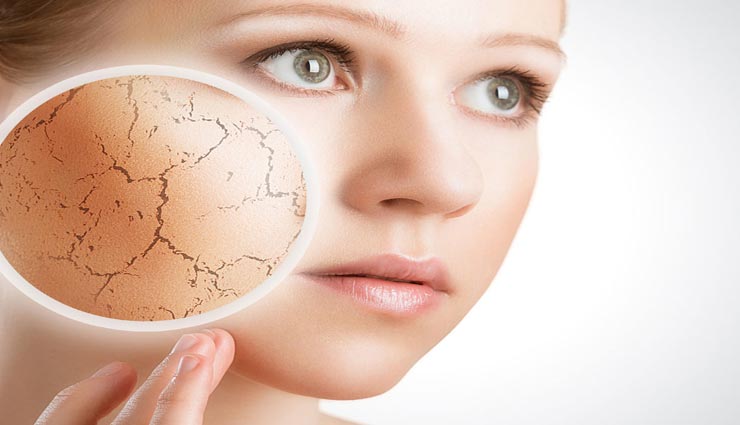 सर्दियों में क्रीम व लोशन का चुनाव करें संभलकर, ध्यान में रखें अपनी स्किन टाइप