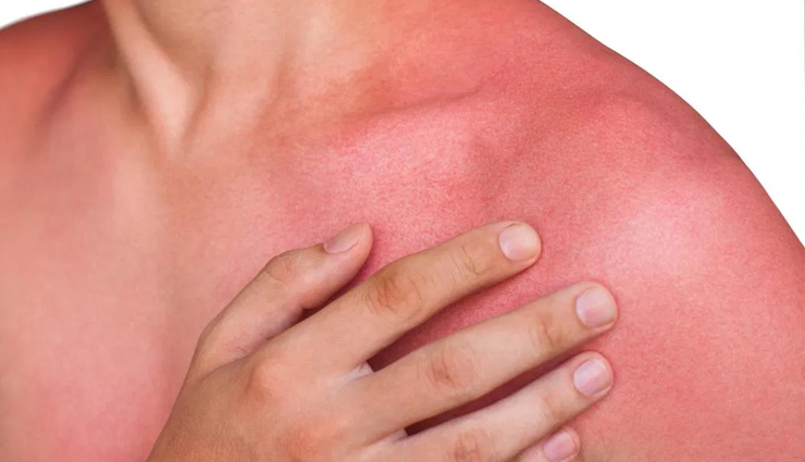 10 beauty benefits,black tea,black tea benefits,beauty benefits of black tea,black tea beauty benefits,beauty,beauty benefits