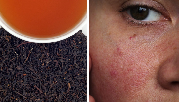 black tea,black tea for skin,black tea for hair,beauty benefits of black tea,amazing beauty benefits of black tea,beauty tips,beauty care tips,skin care tips,hair care tips,home remedies for beauty