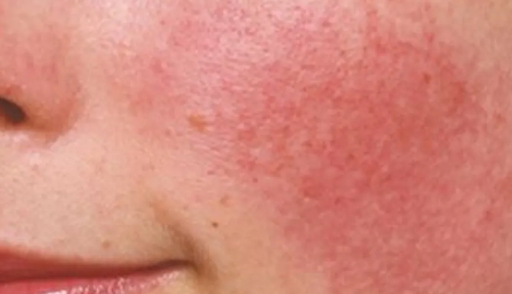 glowing skin tips with peptides,peptides for radiant skin,how to achieve glowing skin with peptides,benefits of peptides for glowing skin,peptides for a youthful glow,tips for using peptides in your skincare routine,achieve glowing skin with peptide skincare,peptides and their role in achieving radiant skin,enhance your skin glow with peptide-based products,the power of peptides for glowing and healthy skin,peptide skincare secrets for a radiant complexion,achieve luminous skin with peptide-infused tips,unlock the glow tips on using peptides for radiant skin,peptides: the key to glowing and youthful-looking skin,discover the magic of peptides for glowing and radiant skin