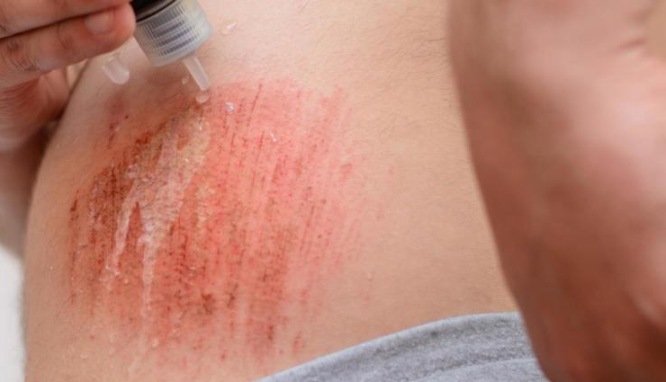 astaxanthin for skin,skin benefits of astaxanthin,astaxanthin skincare,astaxanthin supplements,natural skin care,antioxidant for skin,anti-aging properties of astaxanthin,astaxanthin for radiant skin,skin health with astaxanthin