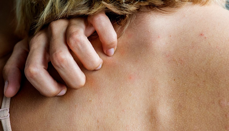 squalane oil benefits for skin,squalane oil uses for skin,squalane oil side effects,benefits of using squalane oil for skin,squalane oil skincare benefits,squalane oil for skin care,squalane oil benefits and uses,squalane oil side effects on skin,squalane oil for skin hydration,natural squalane oil benefits for skin,squalane oil anti-aging effects,squalane oil for sensitive skin,squalane oil acne treatment,squalane oil for dry skin,squalane oil skin moisturizer,organic squalane oil benefits for skin,squalane oil skin protection,squalane oil for skin elasticity,potential side effects of squalane oil on skin,squalane oil skin care tips