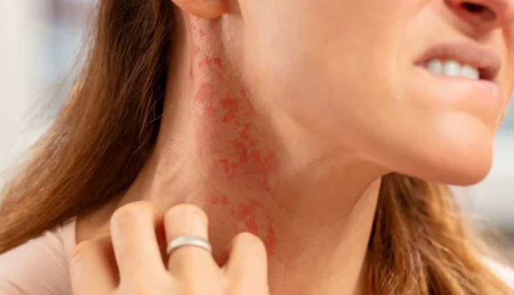 astaxanthin for skin,skin benefits of astaxanthin,astaxanthin skincare,astaxanthin supplements,natural skin care,antioxidant for skin,anti-aging properties of astaxanthin,astaxanthin for radiant skin,skin health with astaxanthin