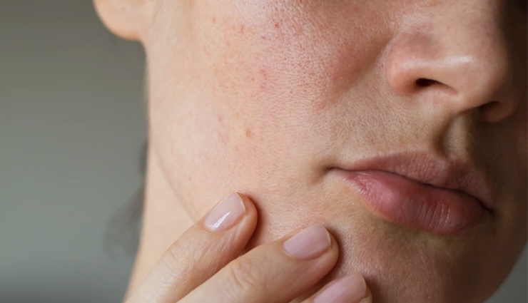 black pepper,amazing health benefits of black pepper,black pepper health benefits,healthy food black pepper,black pepper for good health,Health tips,healthy life