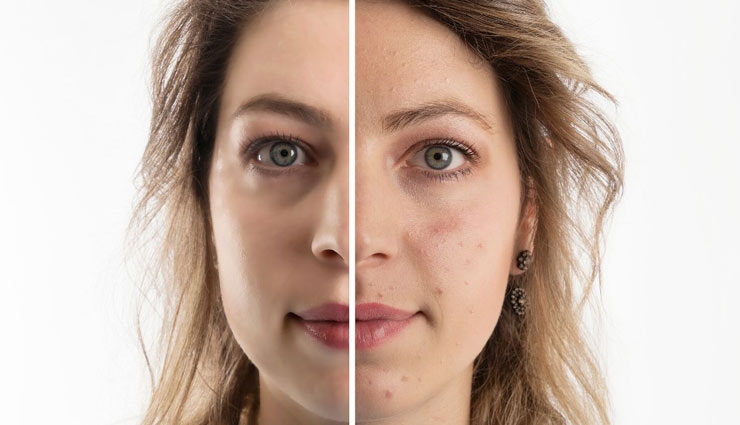 skin lightening,wheat germ for skin lightening,wheat germ,wheat germ face mask,home remedies,skin care tips,beauty tips