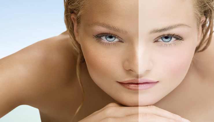 इन नुस्खों को आजमाते ही दिखने लगेगा चहरे पर असर, मिलेगा झाइयों से छुटकारा