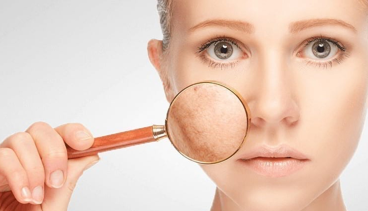 things that happen to your skin if you dont exfoliate timely,beauty tips,beauty hacks