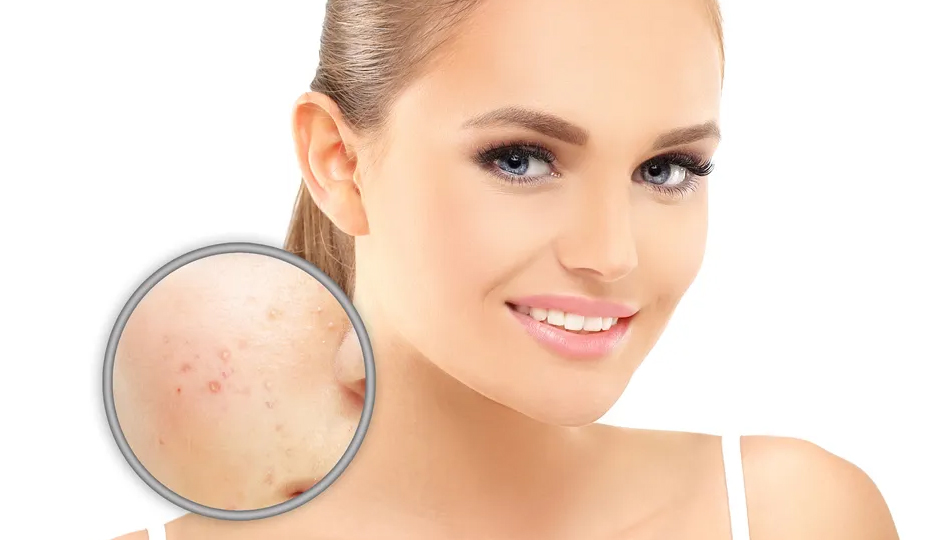 10 DIY Ways To Treat Skin Pigmentation