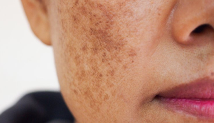 safflower oil skin benefits,benefits of safflower oil for skin,safflower oil skincare benefits,safflower oil beauty benefits,safflower oil uses for skin,lesser-known safflower oil benefits,safflower oil for healthy skin,safflower oil anti-aging benefits,safflower oil moisturizing properties,safflower oil for skin repair,how safflower oil enhances skin health