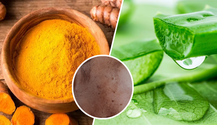 Harness the Power of Turmeric and Aloe Vera Mask for Pigmentation