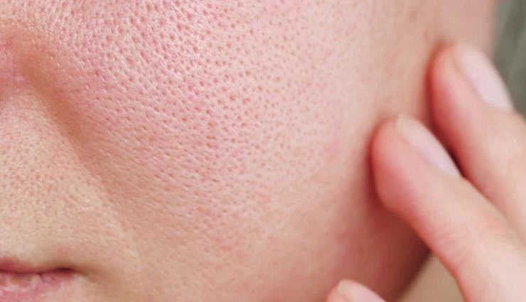 potato juice benefits,face benefits of potato juice,incredible benefits of potato juice for the face,potato juice for glowing skin,potato juice for even skin tone,revitalizing effects of potato juice,potato juice for dull skin,natural skincare with potato juice,potato juice for healthy complexion,nourishing properties of potato juice