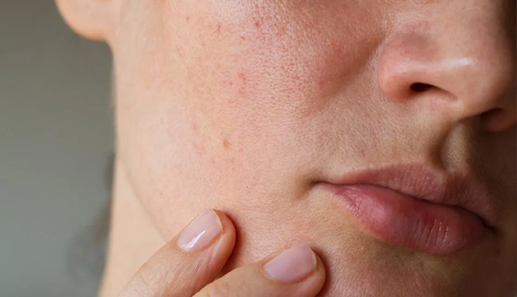 watermelon skin benefits,hydration for skin,antioxidants in watermelon,soothing skin irritation,exfoliating properties of watermelon,brightening skin with watermelon,moisturizing and nourishing effects,sun protection from lycopene,natural skincare with watermelon,watermelon skincare routine,skin hydration tips,anti-inflammatory skincare,skin exfoliation methods,vitamin-rich skincare,protecting skin from uv damage,cleansing with natural ingredients