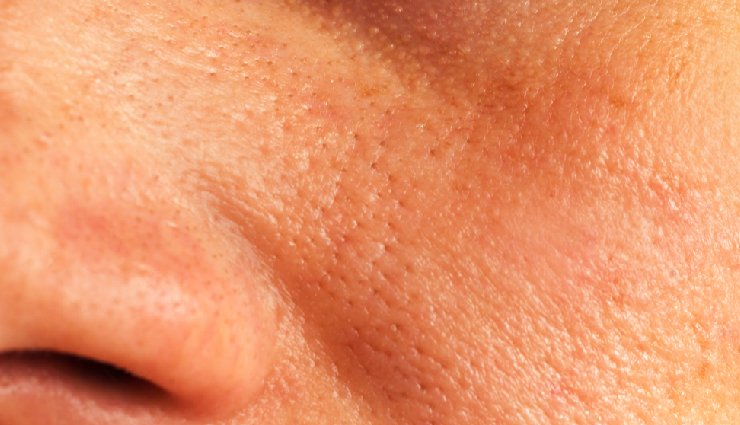 turmeric beauty benefits,haldi for skin glow,curcumin skincare benefits,turmeric face mask benefits,haldi for acne scars,turmeric skin brightening effects,curcumin anti-aging properties,haldi for clear skin,turmeric skincare remedies,haldi face pack recipe