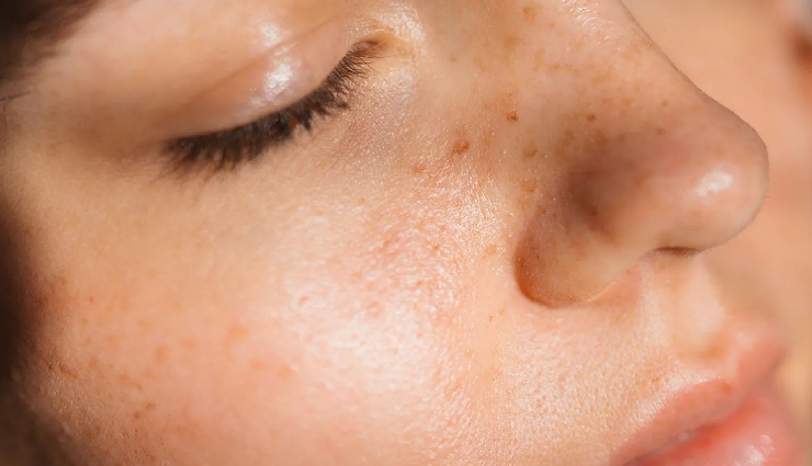 9 Effective Home Remedies To Reduce Skin Pores