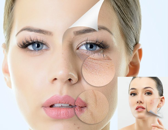 The Best Concealer for Every Skin Problem