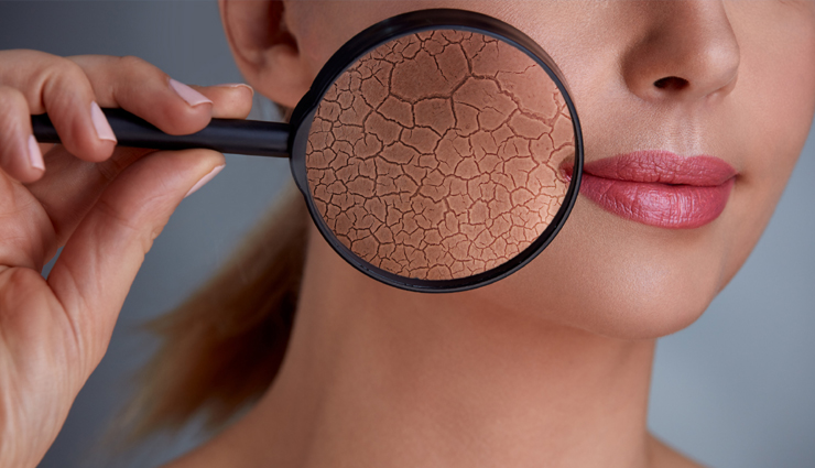 रूखी और बेजान त्वचा से मिलेगी मुक्ति, अपनाए ये घरेलू उपाय