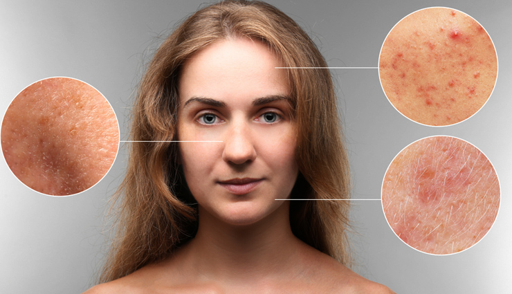 भोजन से जुड़ी ये गलतियां बनती हैं स्किन के लिए नुकसानदायक, लाएं इनमें सुधार 