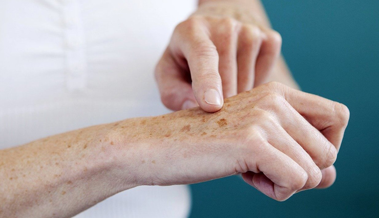 त्वचा के लिए प्रदूषण क्यों है खतरनाक और बचाव कैसे करें? pollution effects on skin,skin damage from pollution,how to protect skin from pollution,pollution and skin health,skin care for pollution protection,best ways to protect skin from pollution,skin protection tips,prevent skin damage from pollution,pollution skincare routine,how pollution harms skin