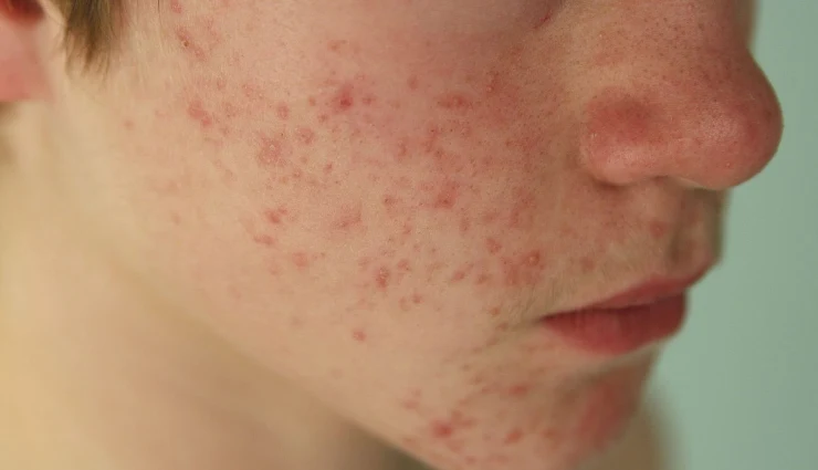 ajwain benefits,carom seeds uses,ajwain for digestion,health benefits of ajwain,ajwain water benefits,ajwain tea for health,ajwain for bloating,ajwain for acidity,ajwain for immunity,ajwain in ayurveda,ajwain for joint pain,ajwain for respiratory health,carom seeds medicinal properties,ajwain detox benefits