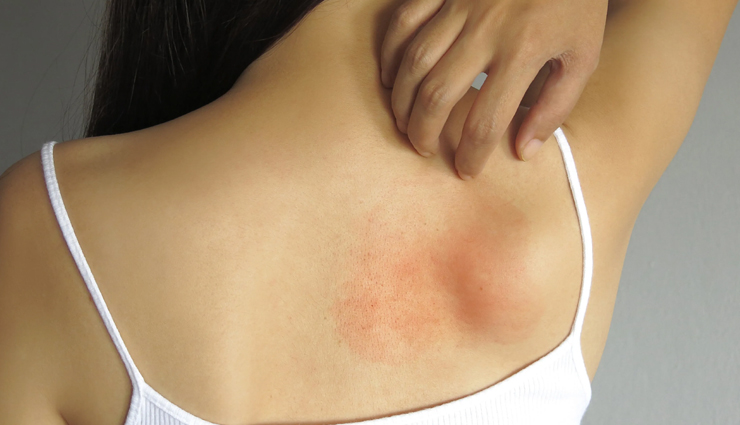 apple cider vinegar side effects,side effects of drinking too much apple cider vinegar,acv side effects on health,negative effects of excessive apple cider vinegar consumption,risks of drinking too much apple cider vinegar,apple cider vinegar drawbacks and side effects,health complications from excessive acv consumption,adverse effects of consuming large amounts of apple cider vinegar