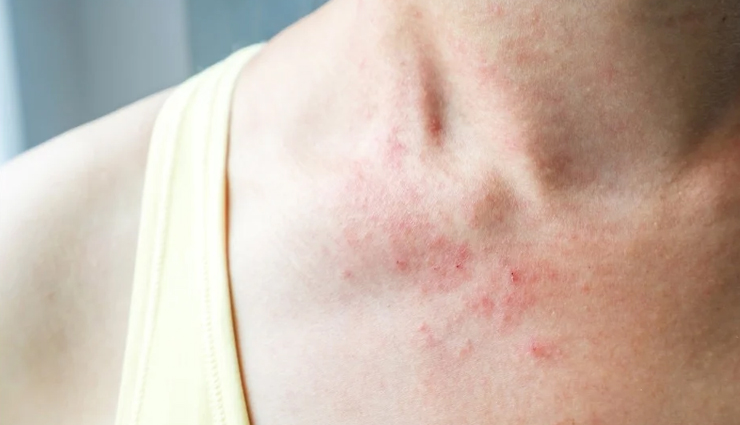 effects of cosmetics on skin,cosmetic ingredients to avoid for skin,harmful effects of cosmetics on skin,safe cosmetics for sensitive skin,how cosmetics affect skin health,cosmetic allergy symptoms,skin reactions to cosmetics,best cosmetics for healthy skin,organic cosmetics benefits for skin,cosmetic safety tips for skin,त्वचा के लिए टिप्स (tvacha ke liye tips),त्वचा के नुस्खे (tvacha ke nuskhe),स्किन केयर टिप्स हिंदी में (skin care tips hindi mein),प्राकृतिक स्किन केयर टिप्स (prakritik skin care tips),ग्लोइंग स्किन के लिए टिप्स (glowing skin ke liye tips),होममेड स्किन केयर टिप्स (homemade skin care tips),स्किन केयर के उपाय (skin care ke upay),स्किन केयर निखराव (skin care nikhraav),स्किन केयर सलाह (skin care salah),स्किन केयर रूटीन (skin care routine)