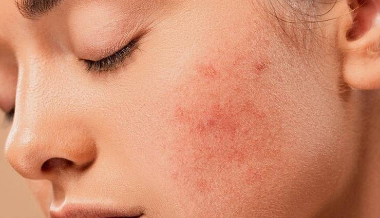 benefits of potato peel,advantages of using potato peels,potato skin health benefits,reasons to keep potato skins,nutritional value of potato peels,potato peel uses,potato peel benefits for skin,cooking with potato skins,health benefits of eating potato skins,why potato peels are good for you,potato peel nutrients,advantages of consuming potato peels,potato peel antioxidant properties,health benefits of potato peel extract,uses for leftover potato peels,dietary benefits of potato skins,ways to use potato peel in cooking,natural remedies using potato peels,potato peel fiber content,potential health advantages of potato skins