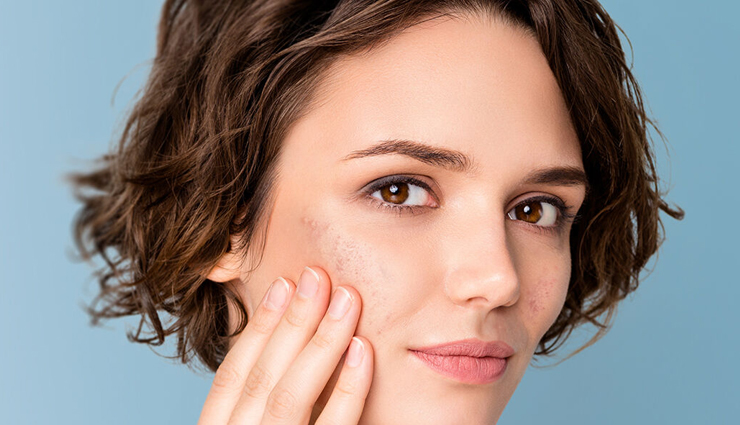 stress and beauty,impact of stress on physical appearance,surprising effects of stress on beauty,beauty problems caused by stress,mental health and beauty,stress and skin problems,hair loss due to stress,dark circles caused by stress,stress and acne,how stress affects your appearance